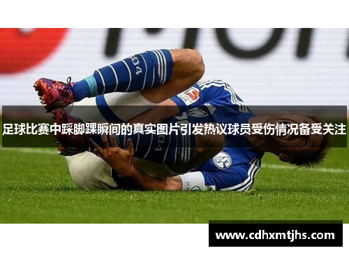 足球比赛中踩脚踝瞬间的真实图片引发热议球员受伤情况备受关注